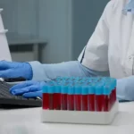 تفسیر نتیجه آزمایش خون | راهنمای جامع و ساده برای جواب آزمایش خون